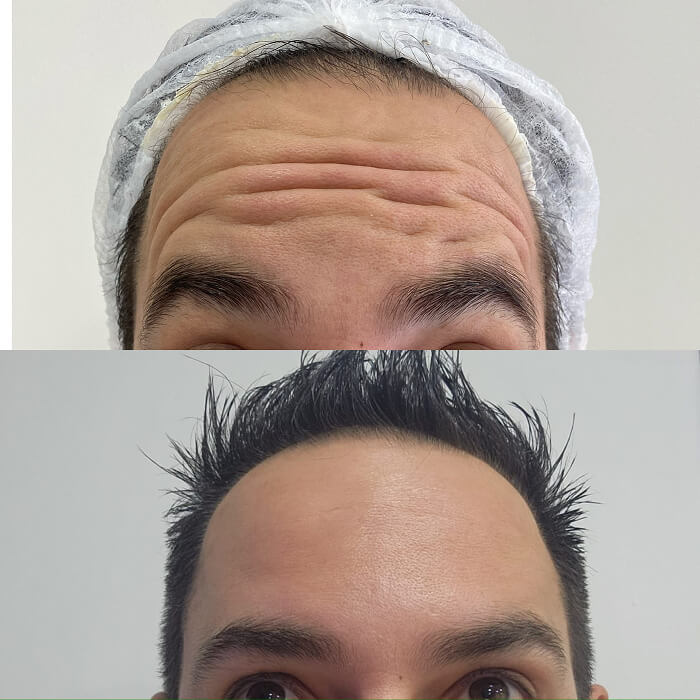 depoimento 23