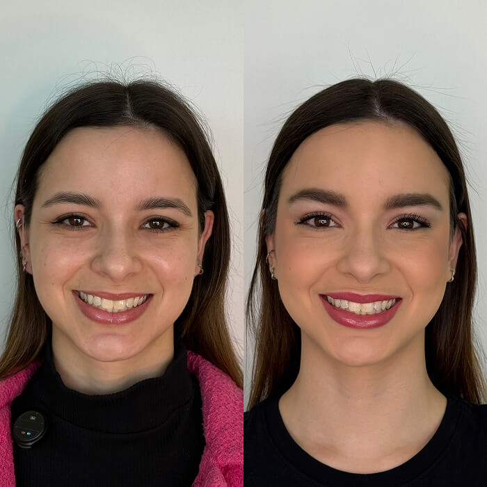 depoimento 28