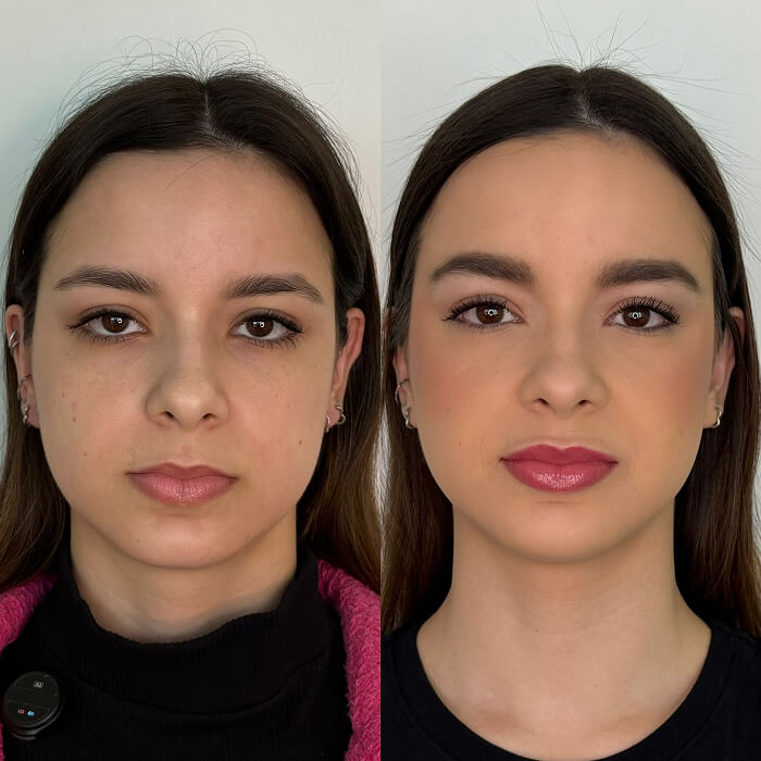 depoimento 29